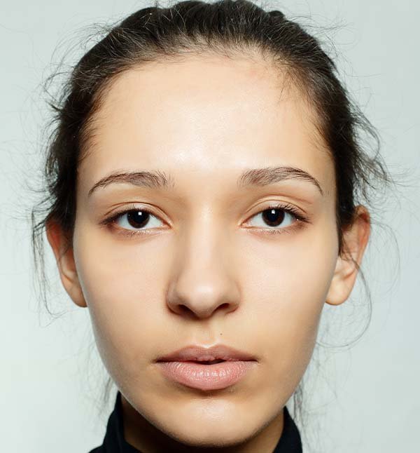 After-facefour