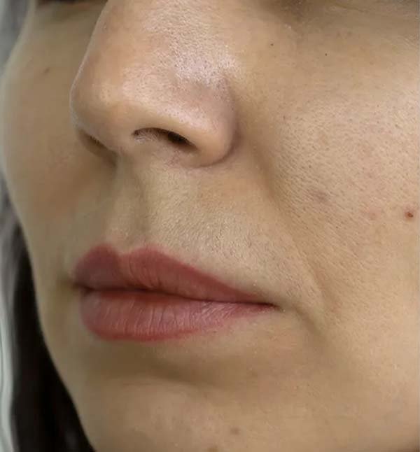 Before-facefour