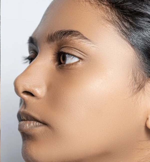 After-facefour