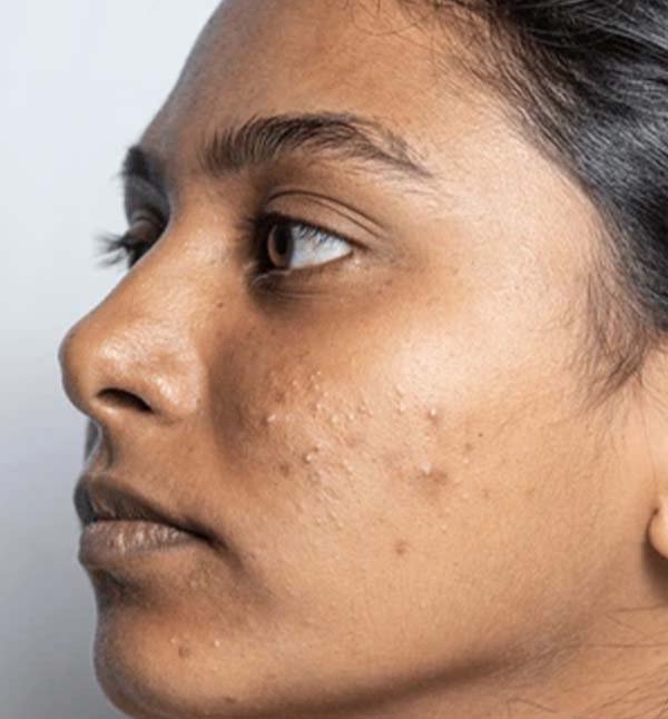 Before-facefour