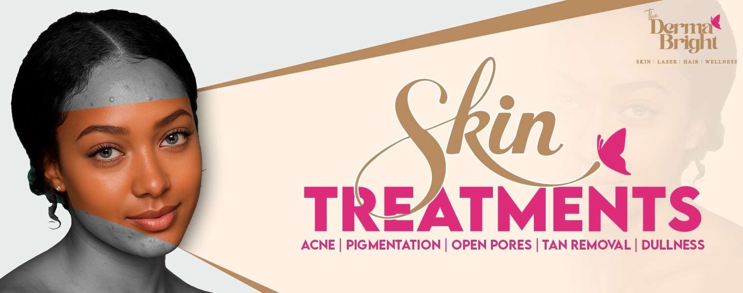 Skincare treatment for acne, pigmentation, and open pores offered by the best Skin Clinic in Lucknow