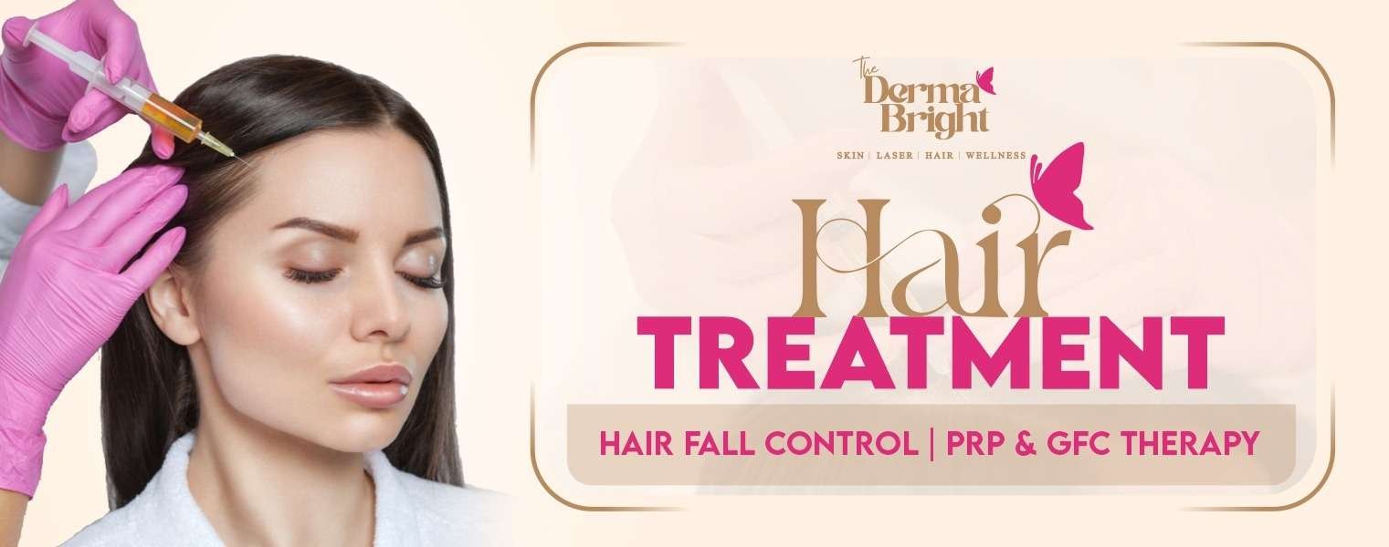 Hair fall control PRP and GFC therapy performed by the bestSkin Clinic in Lucknow on a female patient.