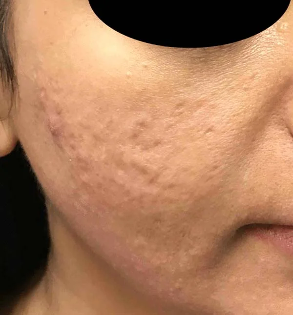 6186before5 6186before5